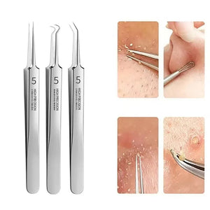 Professional Facial Blackhead Remover Tweezers